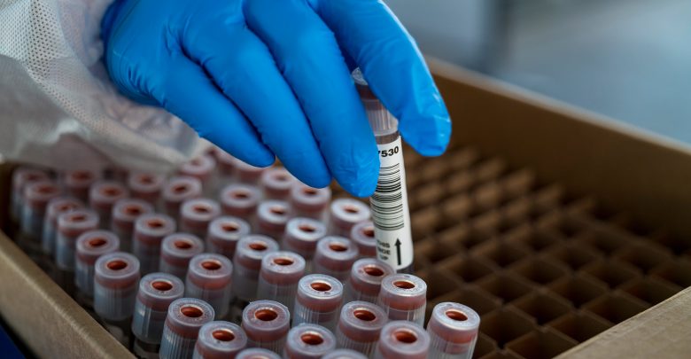 Researchers identify five new cases of variants in California