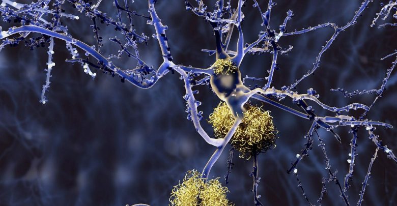 Progression of β-amyloid deposition and consequences for cognitive impairment