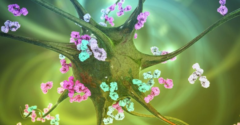 A novel score can identify patients at risk for secondary progressive MS