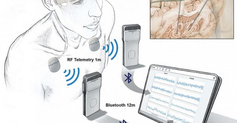 Researchers wirelessly record the activity of the human brain during normal life activities