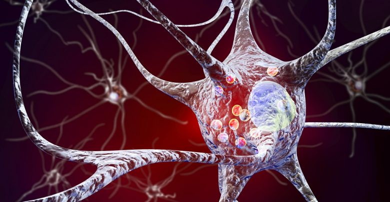 Parkinson's-induced metabolic patterns in the brain as a phenoconversion biomarker