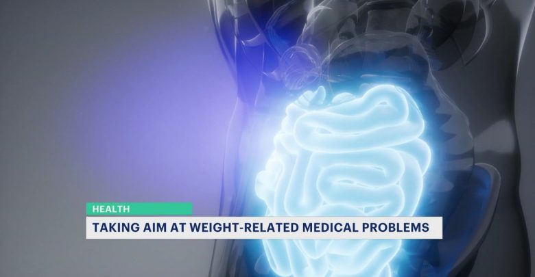 New weight loss treatment helps doctors treat people in the border triangle