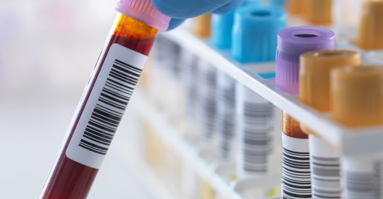 Risk of false low results calls for lead test recall