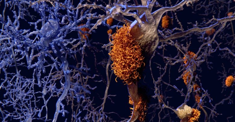 Heterogeneity in Alzheimer's disease progression affects clinical trial results