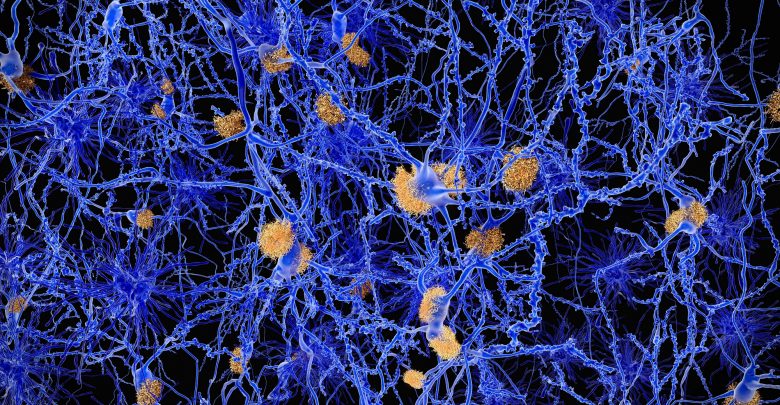ADHD linked to Alzheimer's disease across generations