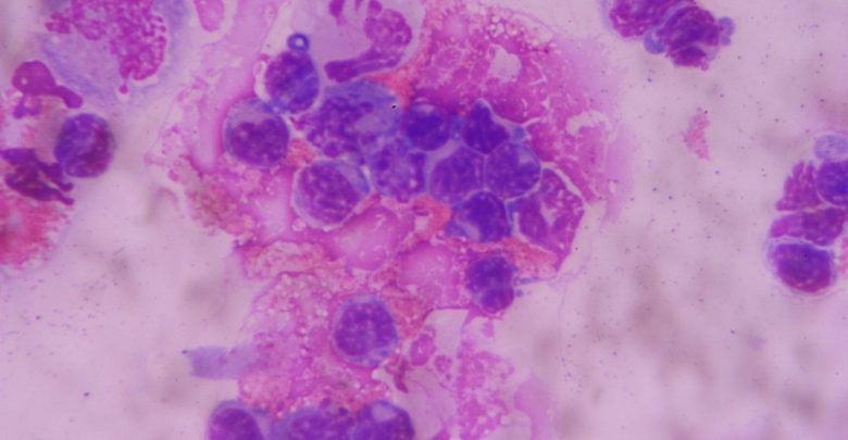 cerebrospinal fluid