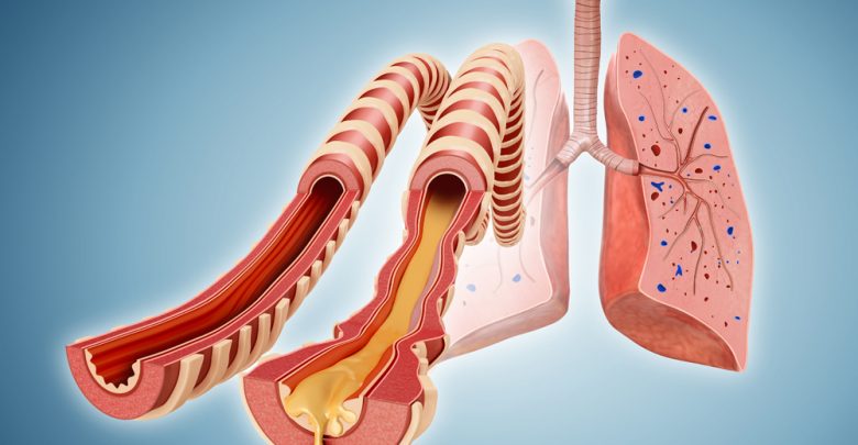 normal vs infected lung bronchi