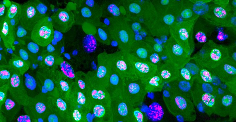 Gut Cells at Different Stages of Erebosis