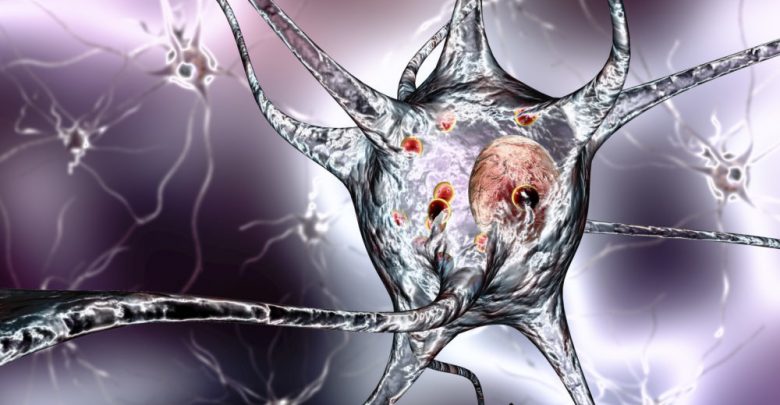 Parkinson-Disease