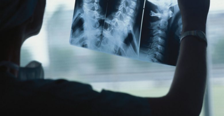 Xray