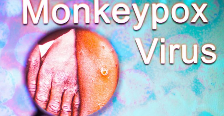 WHO says monkeypox has been spreading undetected as global cases rise to more than 550