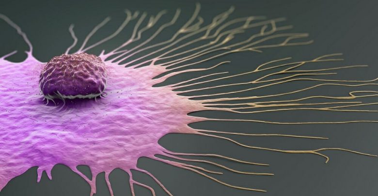 Breast-Cancer