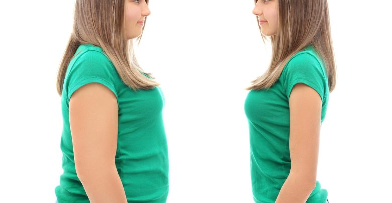 Obesity Weight Loss Concept
