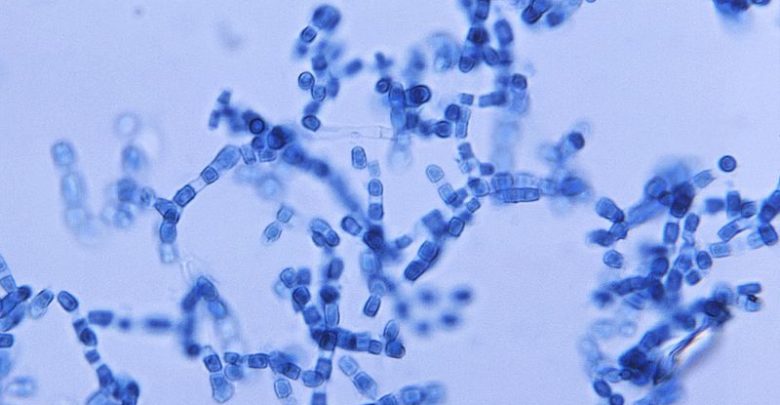 Photo of Coccidioides