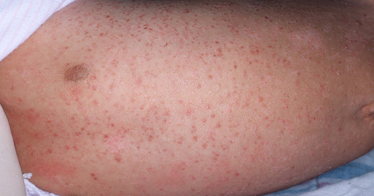 IDC0823WYD_Figure2_1200X630