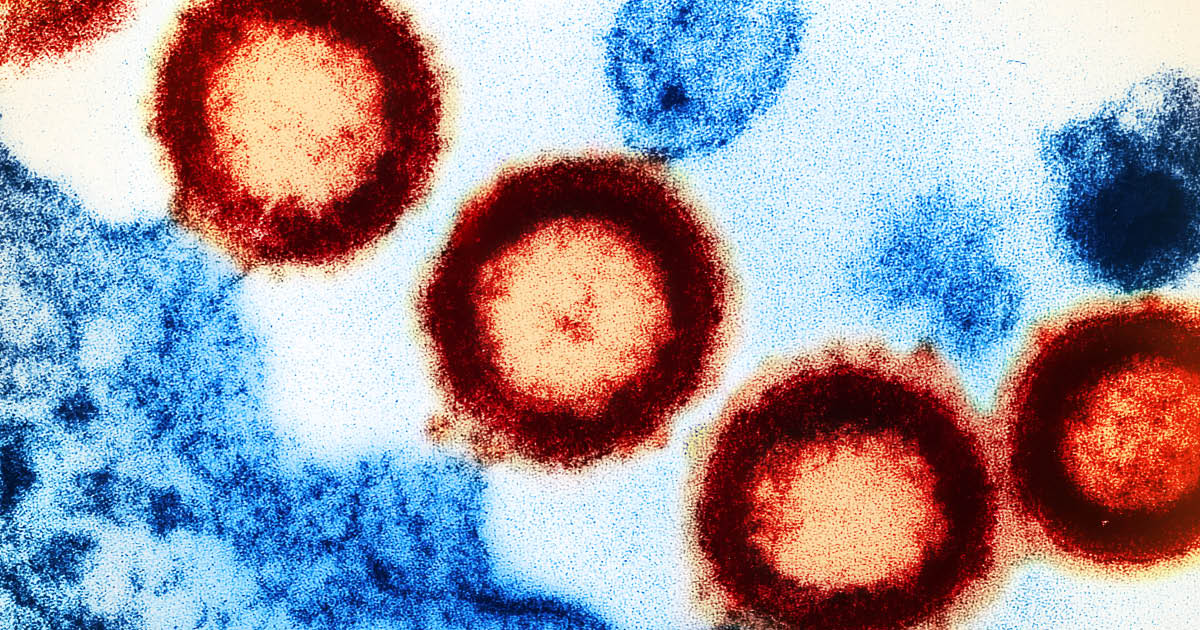 HIV virus particles 3 NIAID