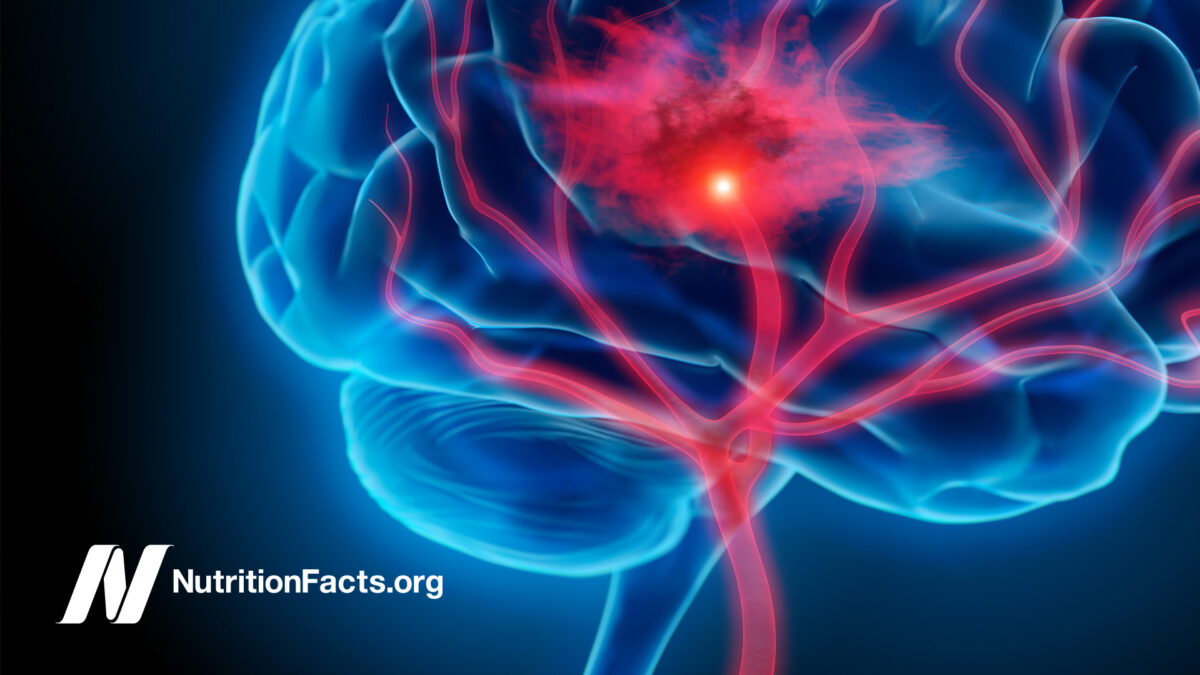 x-ray image of a brain with inflamed arteries