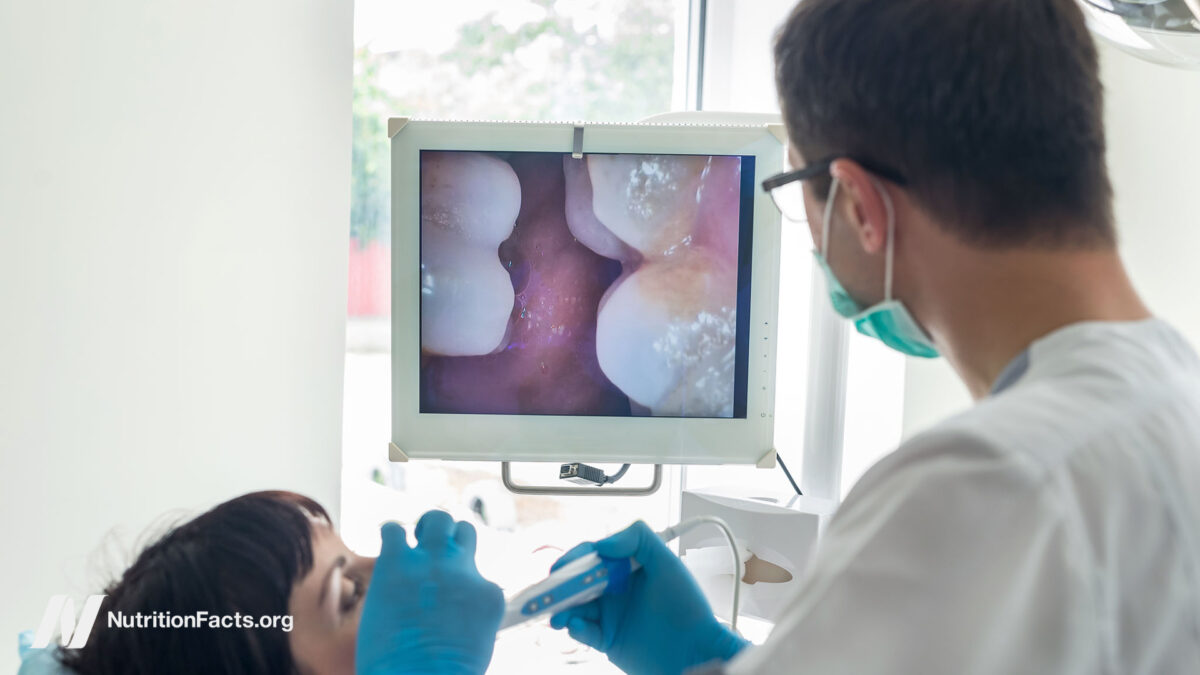 Can We Stop Tooth Decay? 