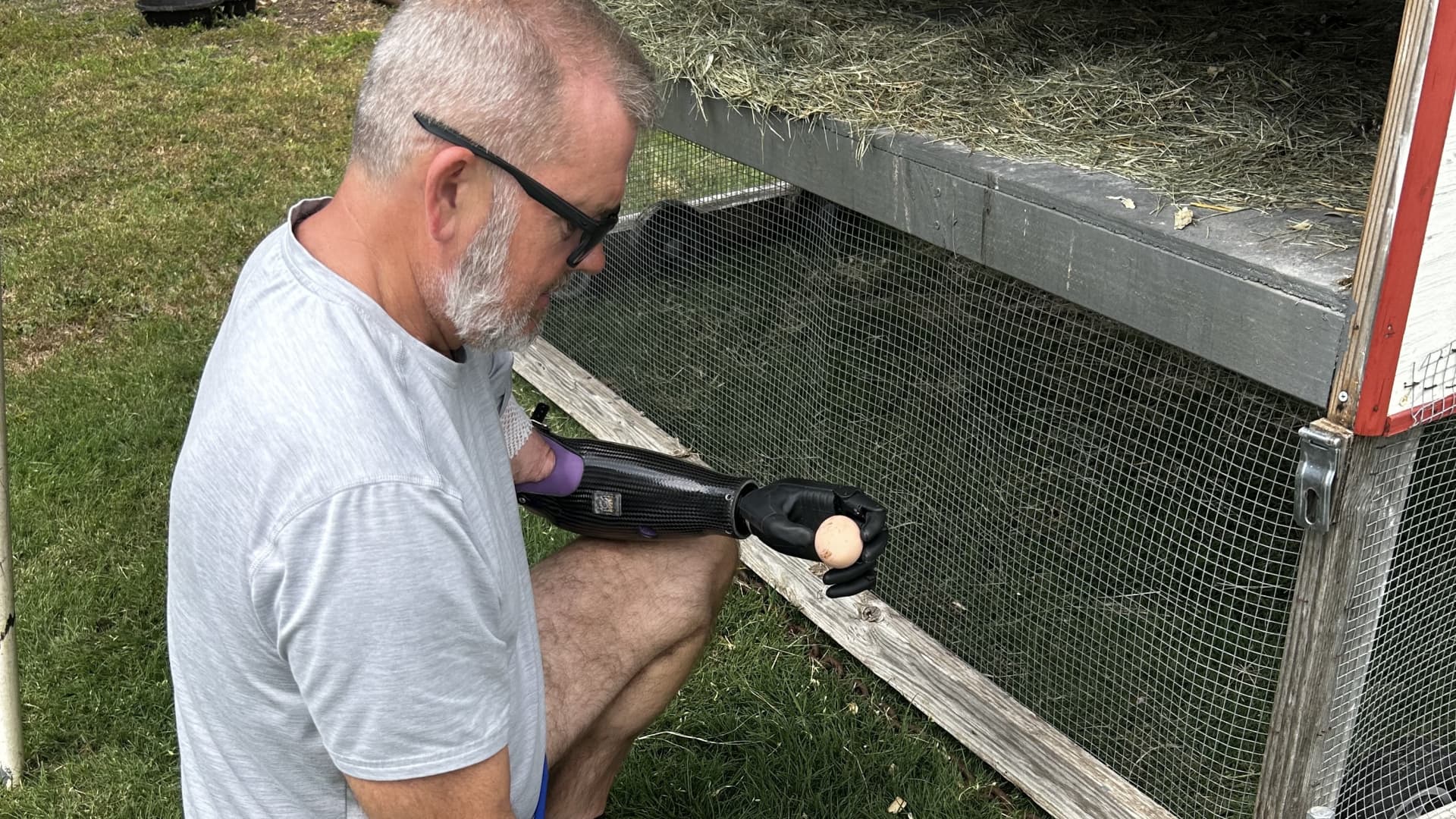 Aether Biomedical, bionic hand startup, gets $5.8 million to scale