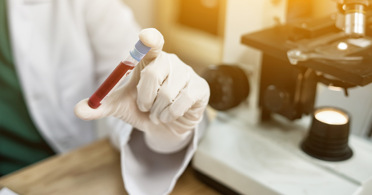Lab technician or doctor holding a blood sample in a tube.