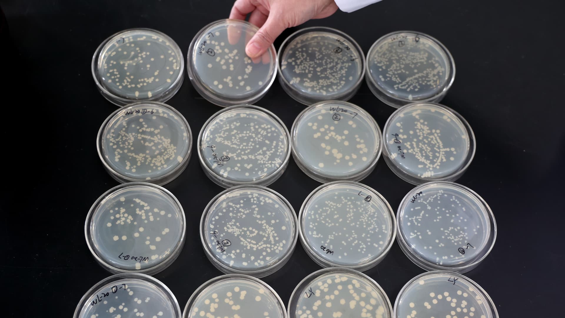 This consumer microbiome startup is betting profits on an AI tool